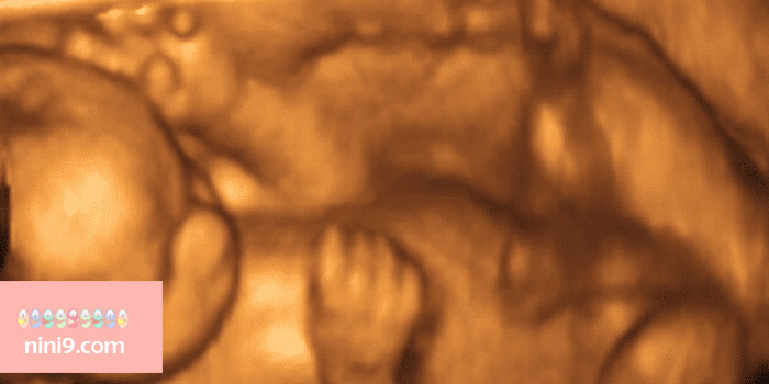 سونوگرافی-هفته-27-بارداری