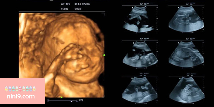 سونوگرافی-هفته-بیست-و-دوم-بارداری