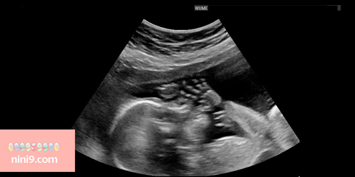 سونوگرافی-هفته-بیست-و-ششم-بارداری