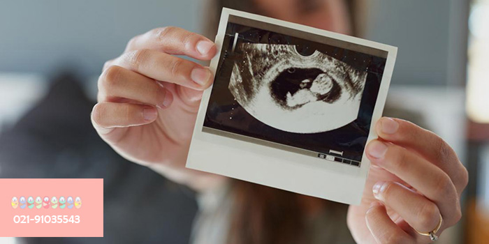 سونوگرافی-هفته-دوزادهم-بارداری